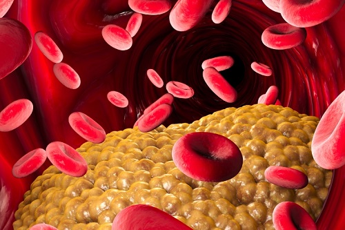 Вся правда о холестерине